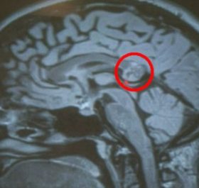 Hình chụp X-quang não bộ của Yamini.